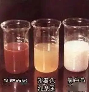 瞿大爷_乳糜_淋巴管