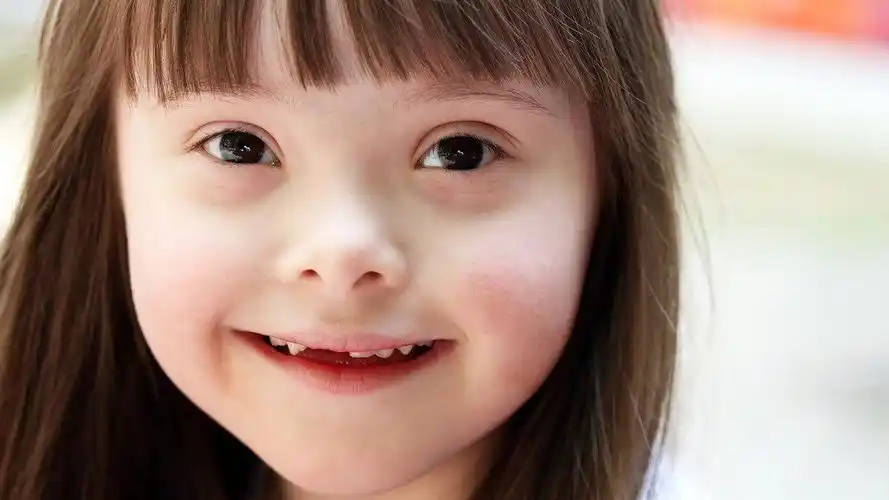 女儿是唐氏综合症结婚当天父亲的一封信感动上万人