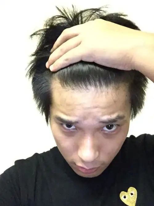 这发际线正常么