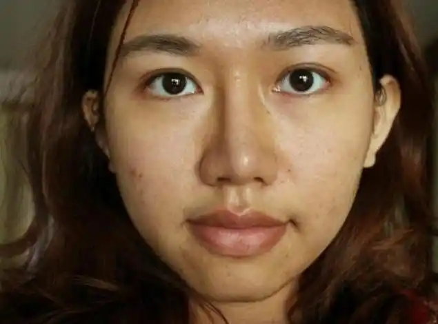 皮肤暗黄粗糙毛孔大是什么原因?如何从生活细节改善?