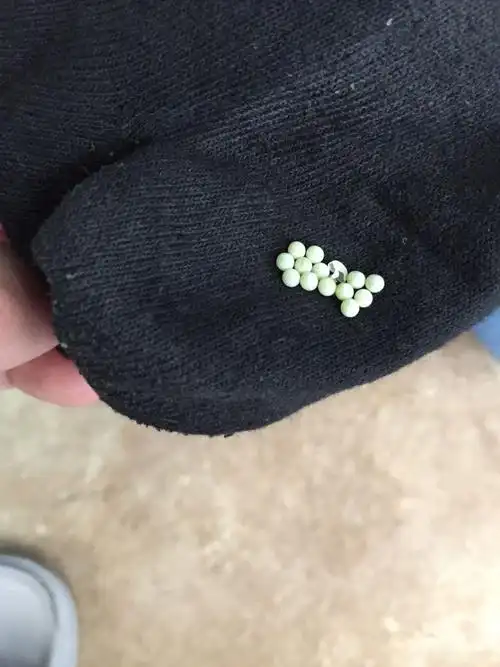 这是什么蛋?长在袜子上了