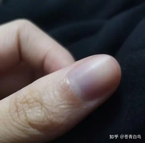 为什么我的指甲会发紫? - 知乎