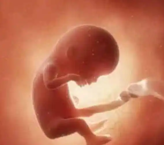 姐妹说,能看到孕10周胎儿的手脚,宝妈们却不相信_cm_身长_宝宝