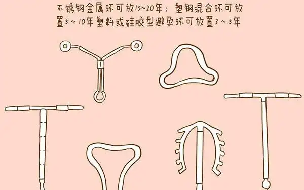 节育环有几种类型 - 避孕环不取对身体有害吗 - 节育环图片 - 柚喜