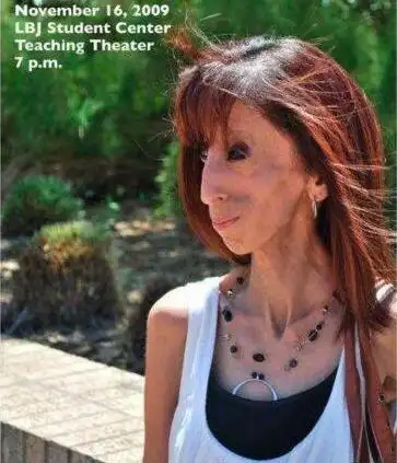 世界上最瘦的人是谁体重仅54斤的美国零脂肪女孩