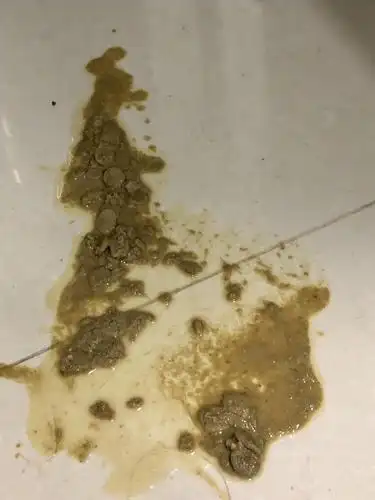 【讨论】多猫变得不爱吃猫粮 最近吃了就吐 爱肯拿