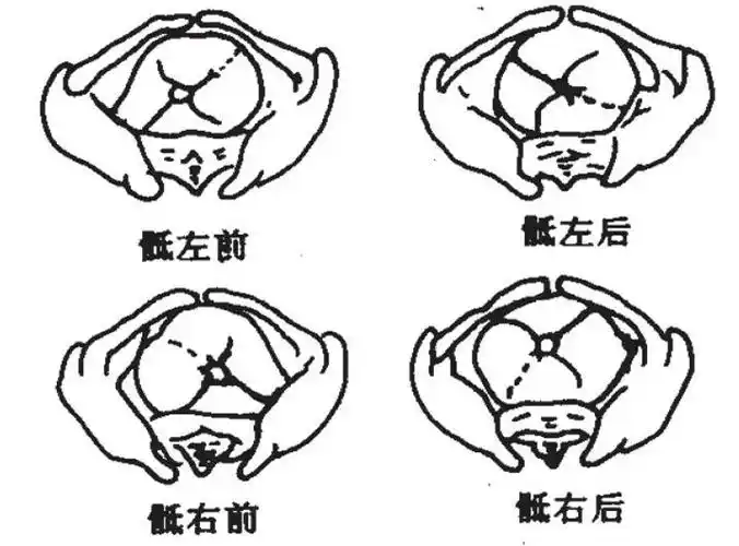 胎方位_胎位总述_胎产式_各胎位缩写 - 头条百科
