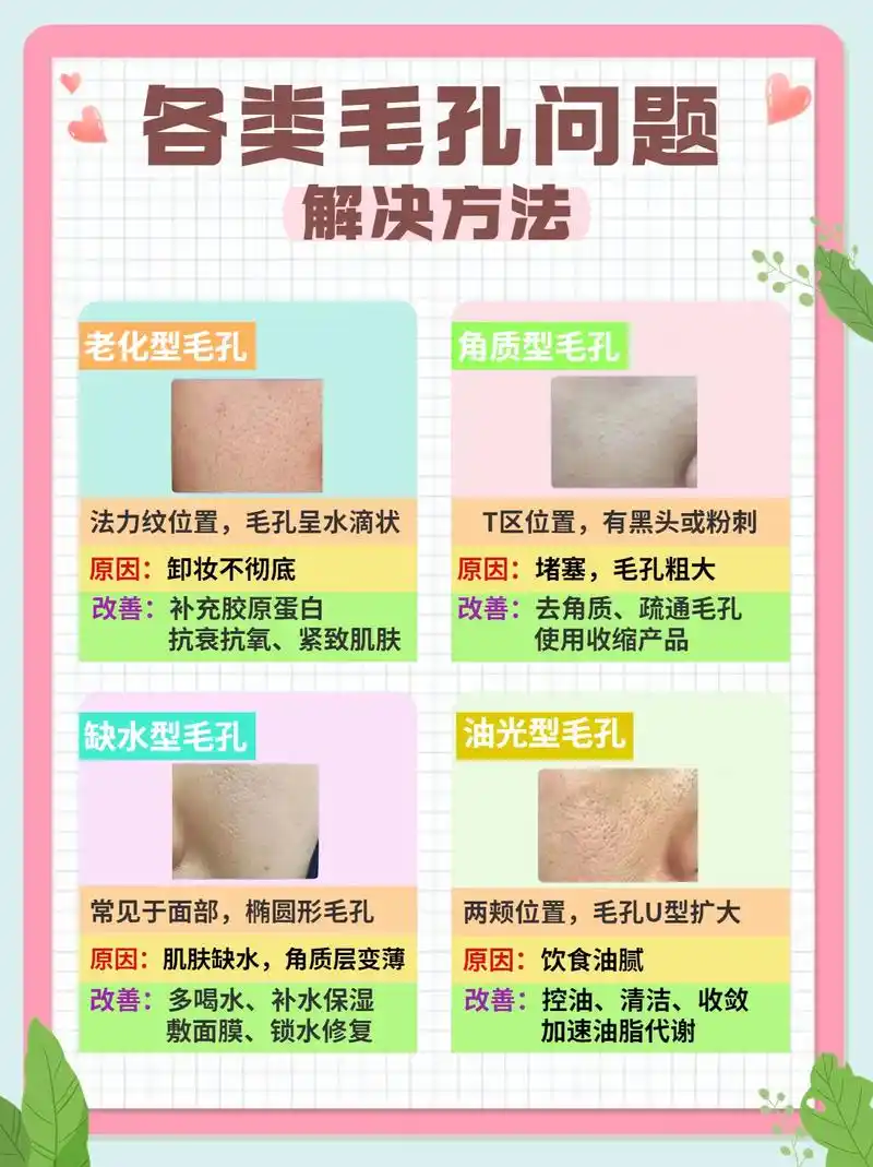 毛恐粗达怎么办71分清毛恐粗达类型,毛恐粗达是很常见的皮肤问题