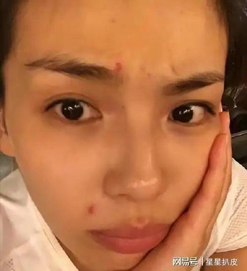 并非都天生丽质,粗腿,痘痘肌,小肚腩堪比常人|痘印|刘亦菲|小肚子