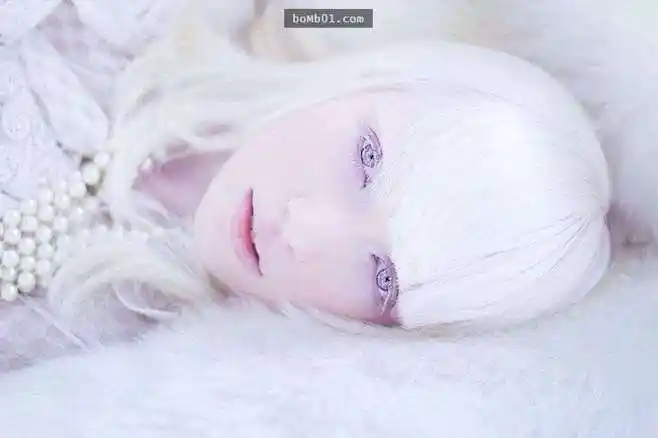 这名患有白化症的18岁俄罗斯女模以过人的勇气,让被人歧视的外表变成