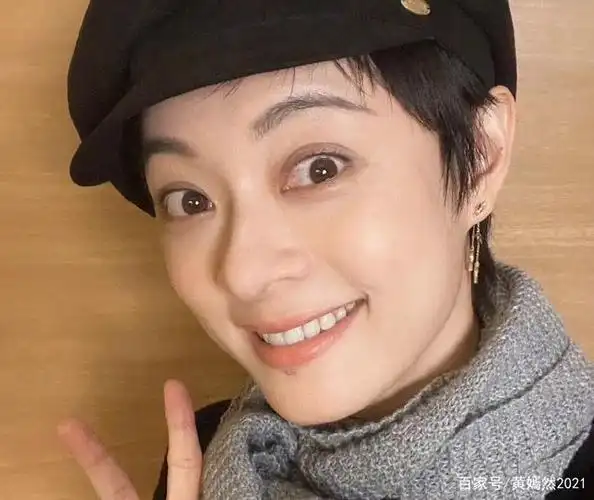 孙俪美貌一去不复返,不只是胶原蛋白的流失