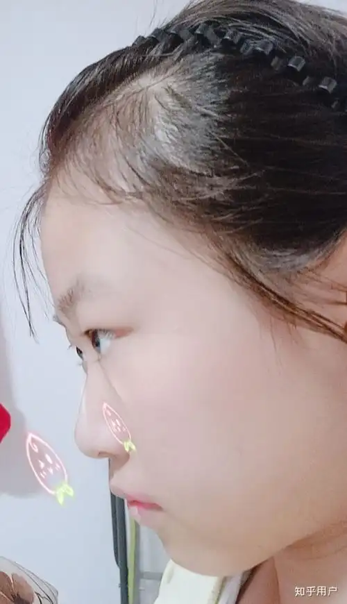 女生塌鼻子是一种什么体验?