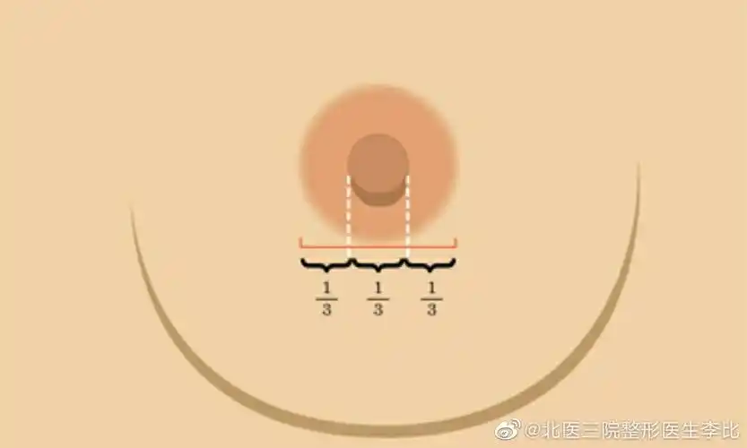 乳头乳晕常见问题有哪些?