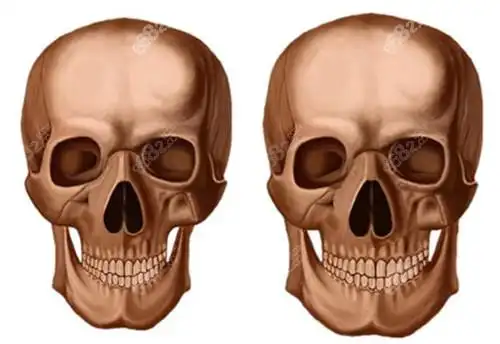 听说他超长弧下颌角改脸型很赞,颌面对比照-8682赴韩整形网