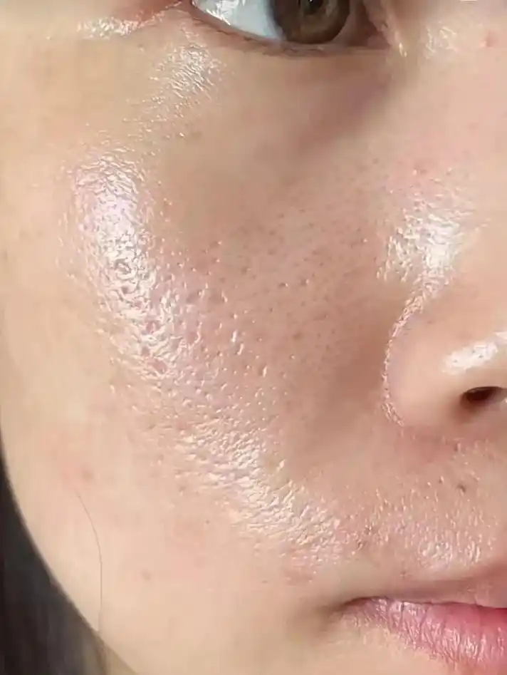 毛孔大是真的很糟心,遮也遮不住! 每次看 - 抖音