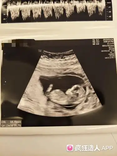 一胎宝宝,男孩女孩都一样爱