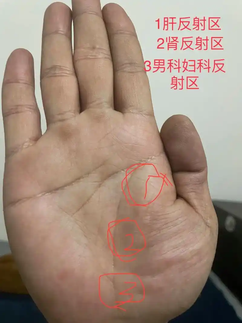 生命线断了的都过来了啊,分析分析原因.生命线断不可怕,可怕的 - 抖音