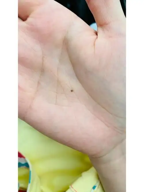 右手掌心痣寻找有缘人快出来快出来