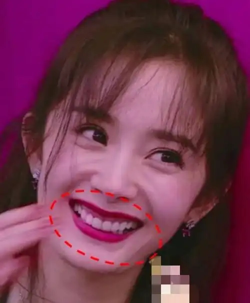 很多网友都说,只要刘亦菲不笑那就是完美的,主要是她笑起来的时候暴露