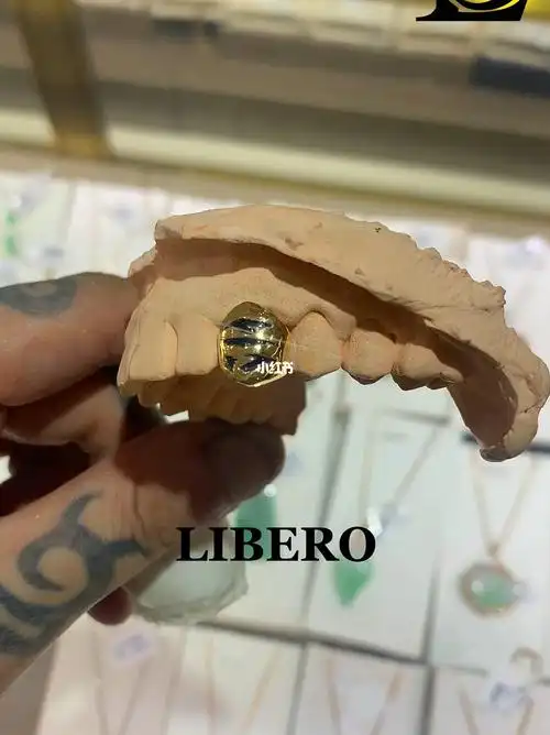 libero虎牙单颗18k黄金牙套定制grillz