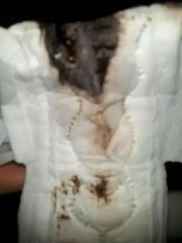 月经七月四号刚走第二次来月经,昨天游泳之后发现的,昨天上午zw一次