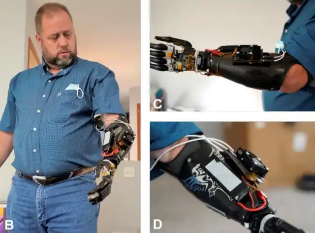 可意念控制的神经假肢诞生手势识别准确率超95专访