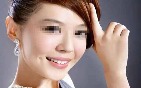 长沙手术肋骨垫高鼻子整形排名前三的医院有哪些?