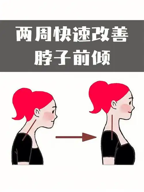 4动作 3要素,快速挽救脖子前倾!缓解不适感