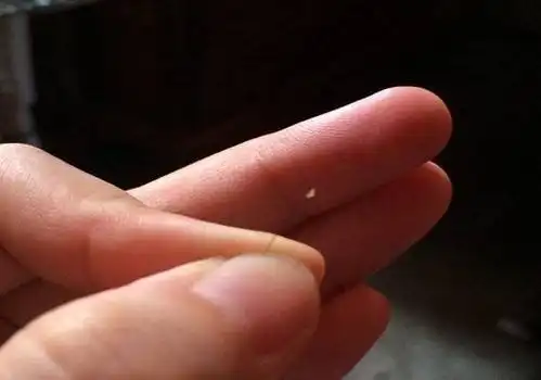 发问掉发发根上的白点是脱落的毛囊么