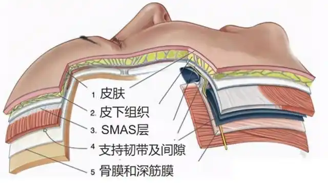 抗衰筋膜层是基础,真正的抗衰不能浮于表面!