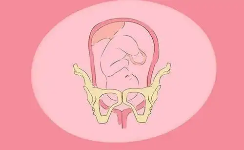 孕晚期,准妈妈有这3个特征,说明胎儿入盆了