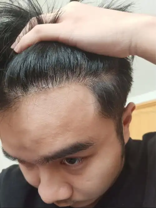 什么样的发际线是正常的_发型图片