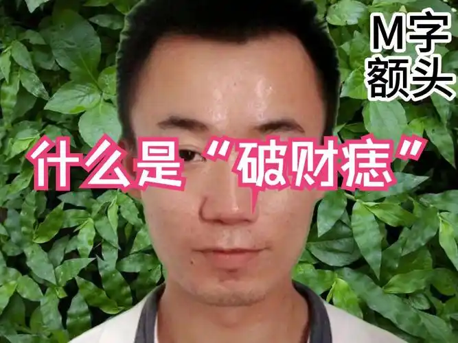 这里有"恶痣"中年必破财