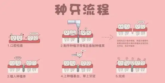 种植牙价格更"亲民",但这些流程必知晓!
