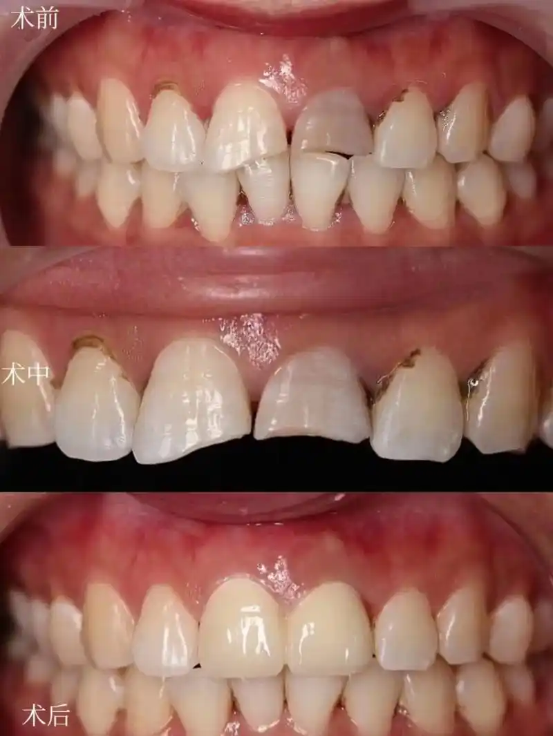 想美白牙齿,想变美的.【美业人群有需求,请千万别盲目】 不管 - 抖音