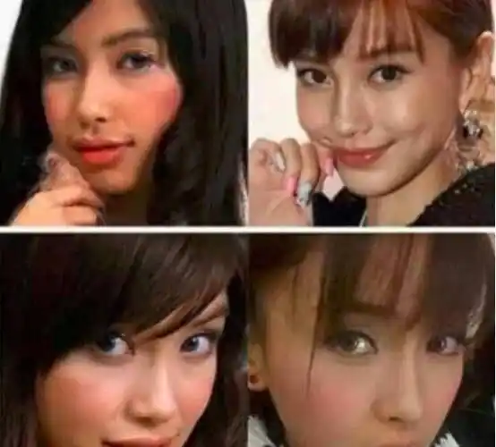 angelababy变脸前旧照流出,笑起来嘴歪脸严重畸形,有点像凤姐_明星