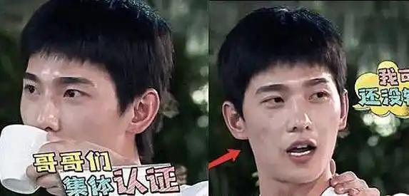 杨洋参加综艺时被曝光生图,镜头拉近看到满脸的伤痕后,我心疼了_因为