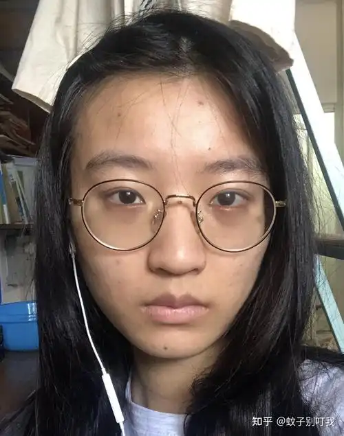 22岁普通女大学生皮肤暗黄没有光泽怎么短时间内提亮肤色美白呢