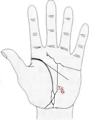 生命线尾部出现大岛纹