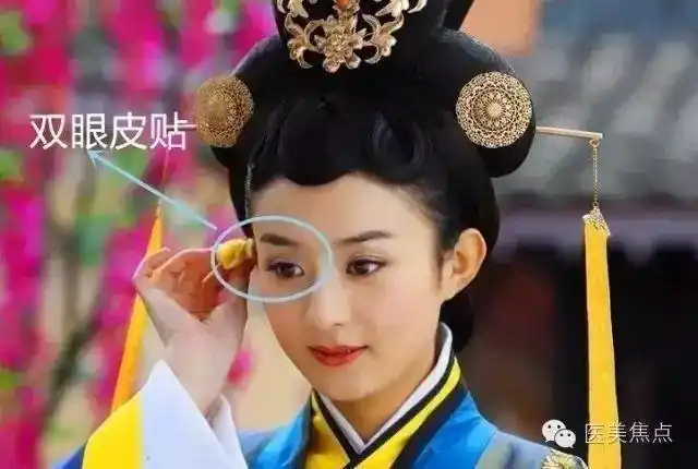 一劳永逸,再也不用靠贴双眼皮贴get大眼啦眉毛刚进娱乐圈的赵丽颖real