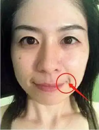 女人脸上的四颗离婚痣,易导致婚姻不顺,蕞好点掉!