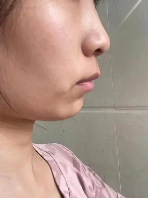 真心建议跟我一样下巴的姐妹花小钱办大事