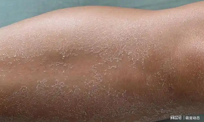 首先要知道引起我们皮肤干燥的原因是什么?