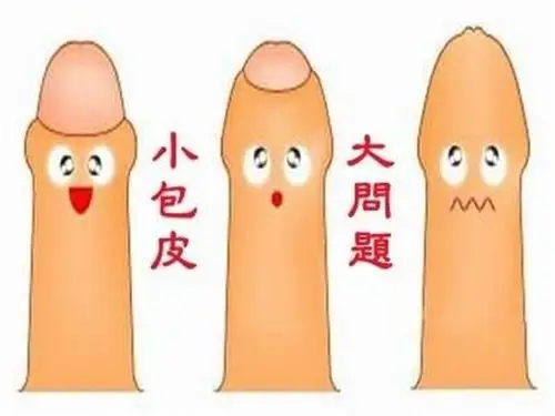 岁少年包茎手术前照片_有来医生