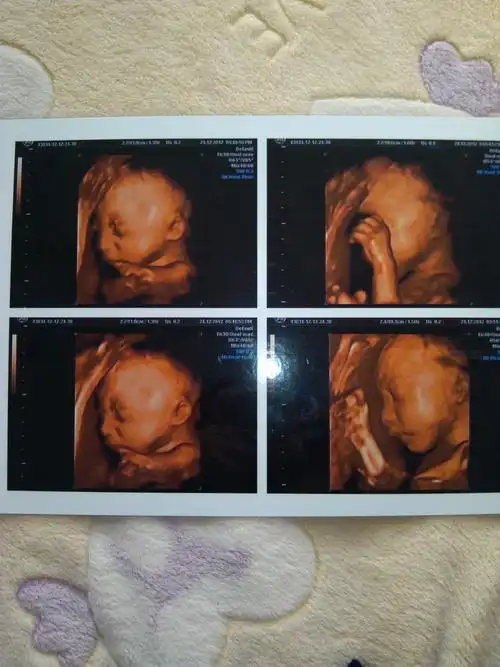 宽裕!男女怎么才能怀上宝宝"爆料评论"-第2张图片-南坊网