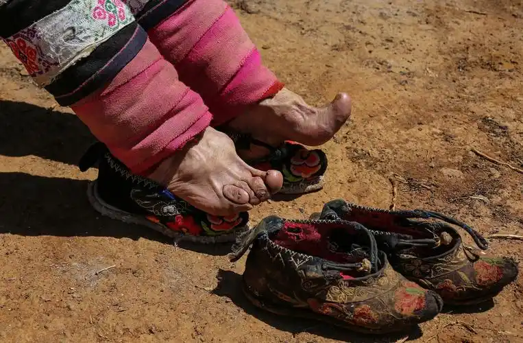 最后的"三寸金莲"老人