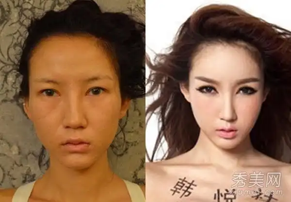 柳岩承认整容 细数公开承认整容的明星(组图)