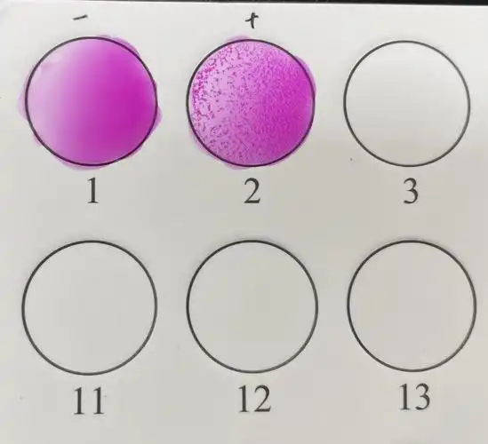 布氏杆菌病虎红平板凝集试验操作及注意事项!_进行_检测_血清