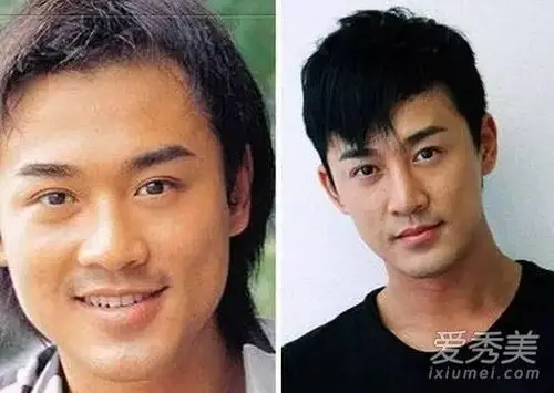 打死也不承认!那些娱乐圈整容到面瘫的男星 明星整容前后照片对比