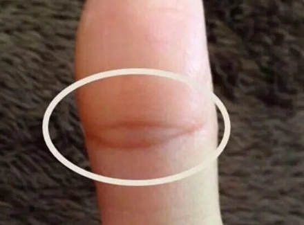 凤眼纹没封住是啥意思?其实很好理解-996手相网